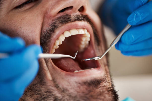 Best Emergency Dental Care for Broken or Chipped Teeth in Cle Elum, WA